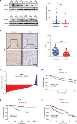 ACADL Functions as a Tumor Suppressor in Hepatocellular Carcinoma Metastasis by Inhibiting Matrix Metalloproteinase 14